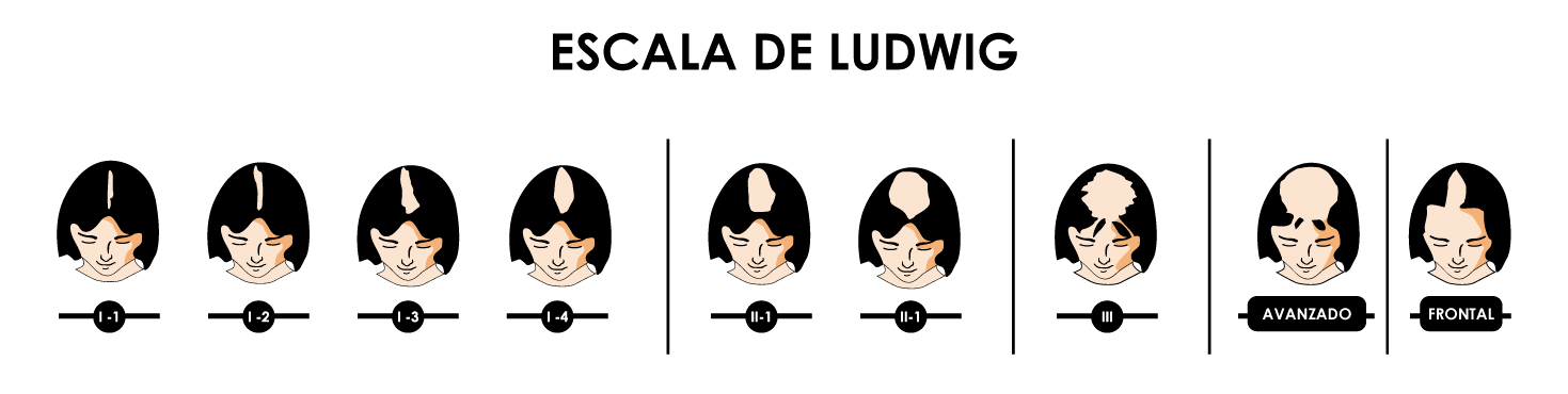 Escala de Ludwig
